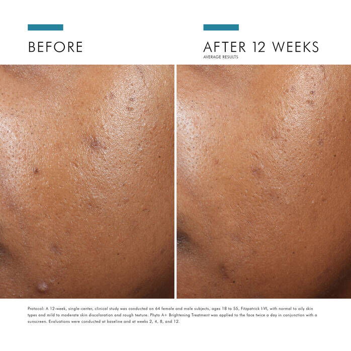 Phyto A+ Brightening Treatment Moisturizer