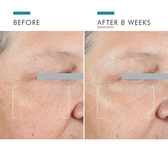 A.G.E. Advanced Eye Cream for Dark Circles