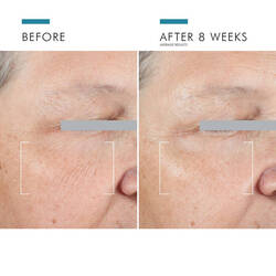 A.G.E. Advanced Eye Cream for Dark Circles