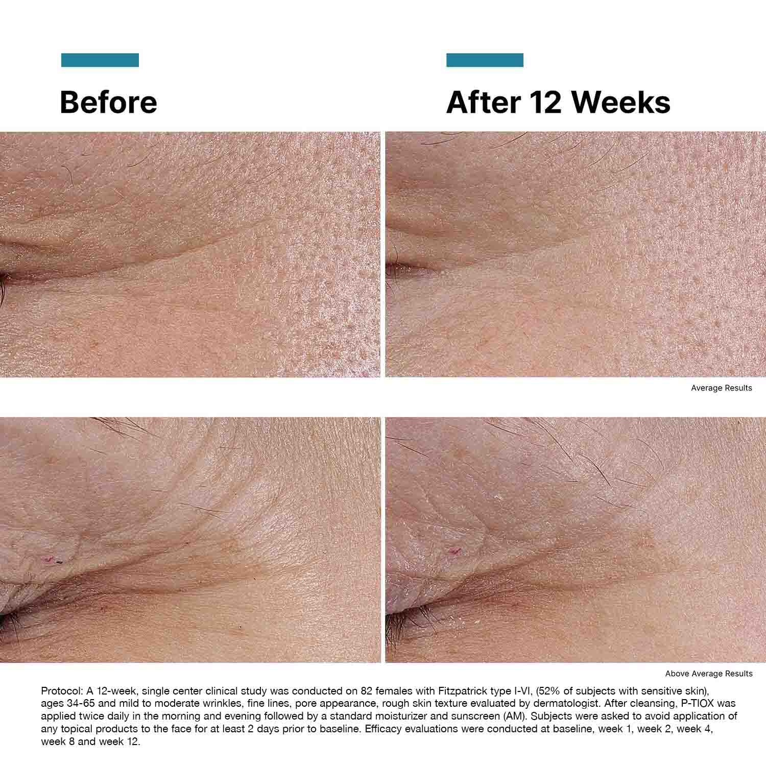 P-TIOX Anti-Wrinkle Peptide Serum