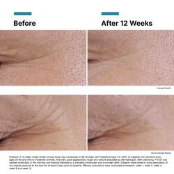 P-TIOX Anti-Wrinkle Peptide Serum