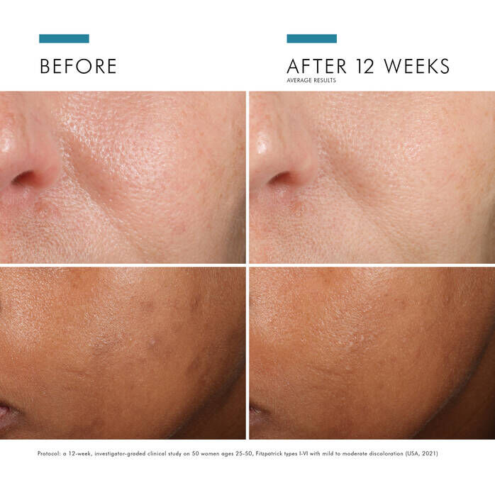 Phloretin CF with Ferulic Acid
