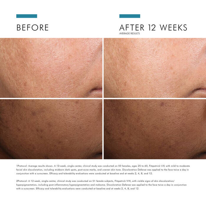Discoloration Defense Serum