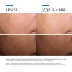 Discoloration Defense Serum