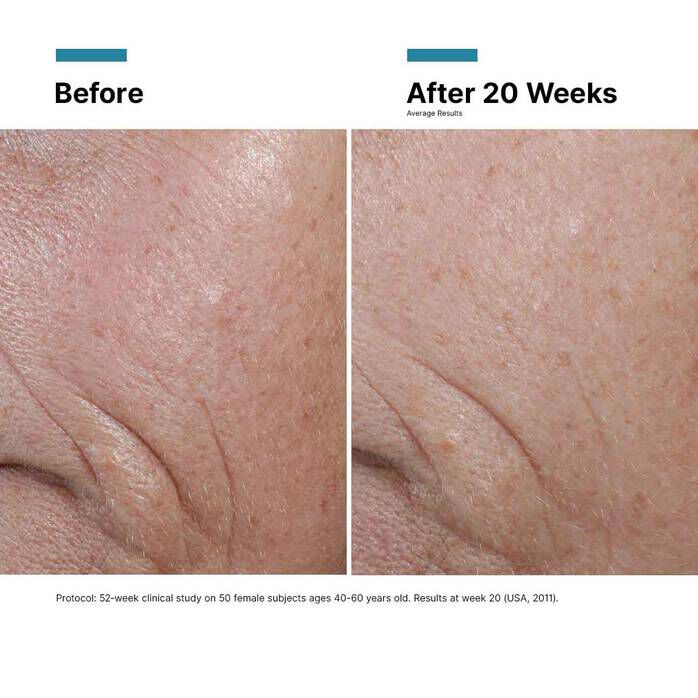 C E Ferulic with 15% L-Ascorbic Acid