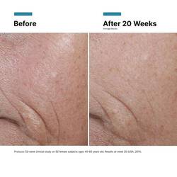 C E Ferulic with 15% L-Ascorbic Acid