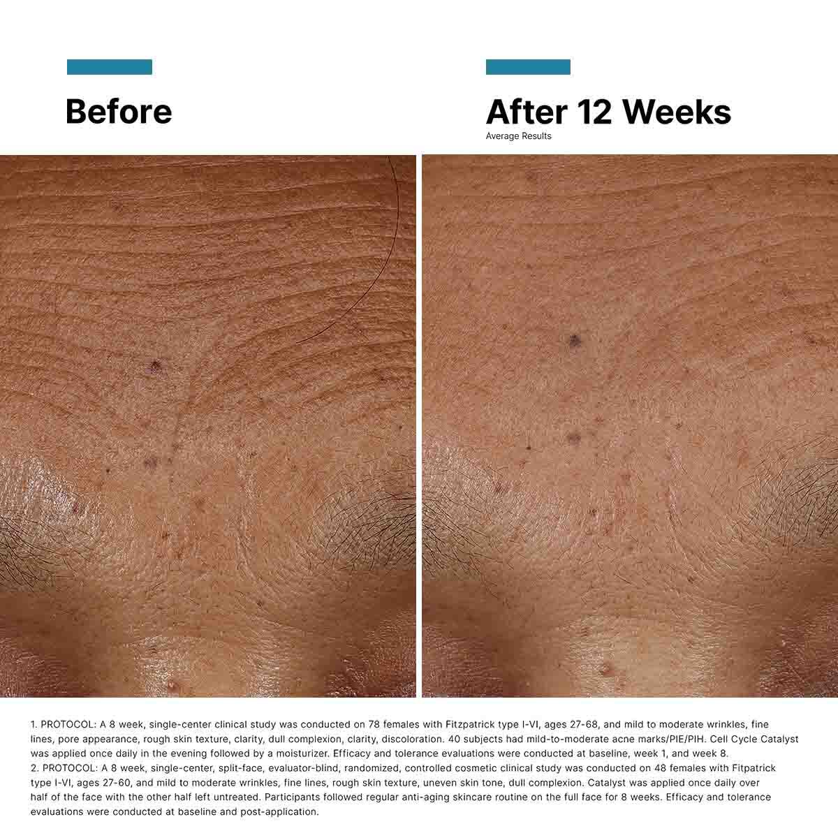 Hyaluronic Acid Intensifier Multi-Glycan Serum