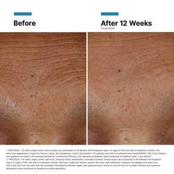Hyaluronic Acid Intensifier Multi-Glycan Serum