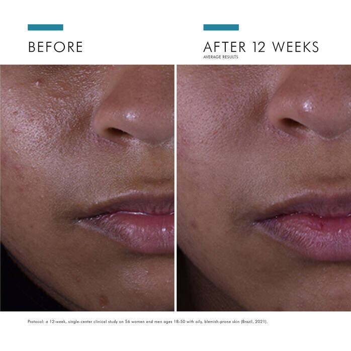 Silymarin CF Vitamin C Serum for Oily Skin