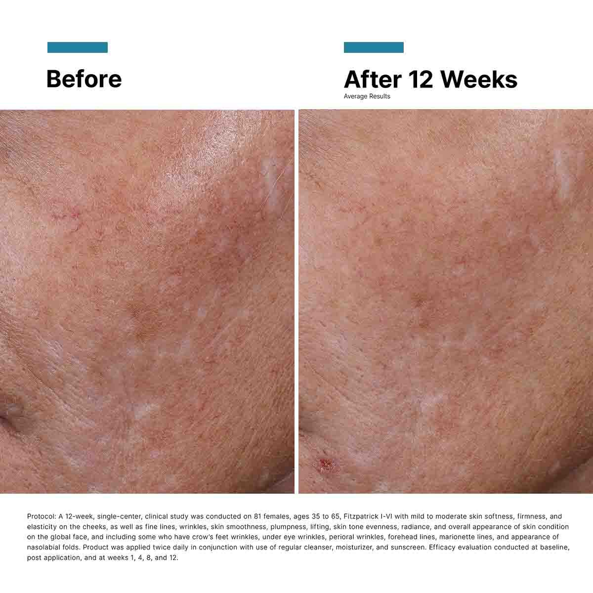 Hyaluronic Acid Intensifier Multi-Glycan Serum