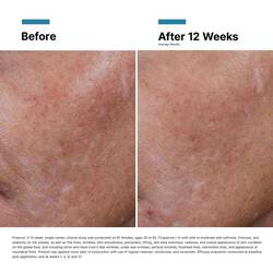 Hyaluronic Acid Intensifier Multi-Glycan Serum