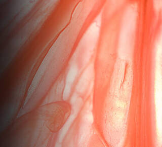 Endophytol Image