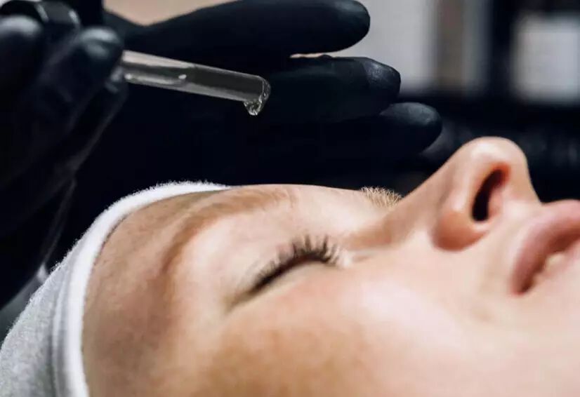 Chemical Peels