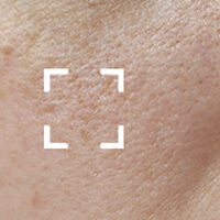 Peptide-Serums