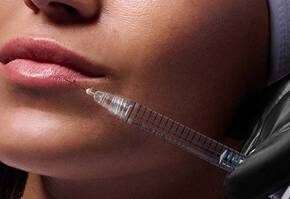 Injectable Hyaluronic Acid Filler Banner