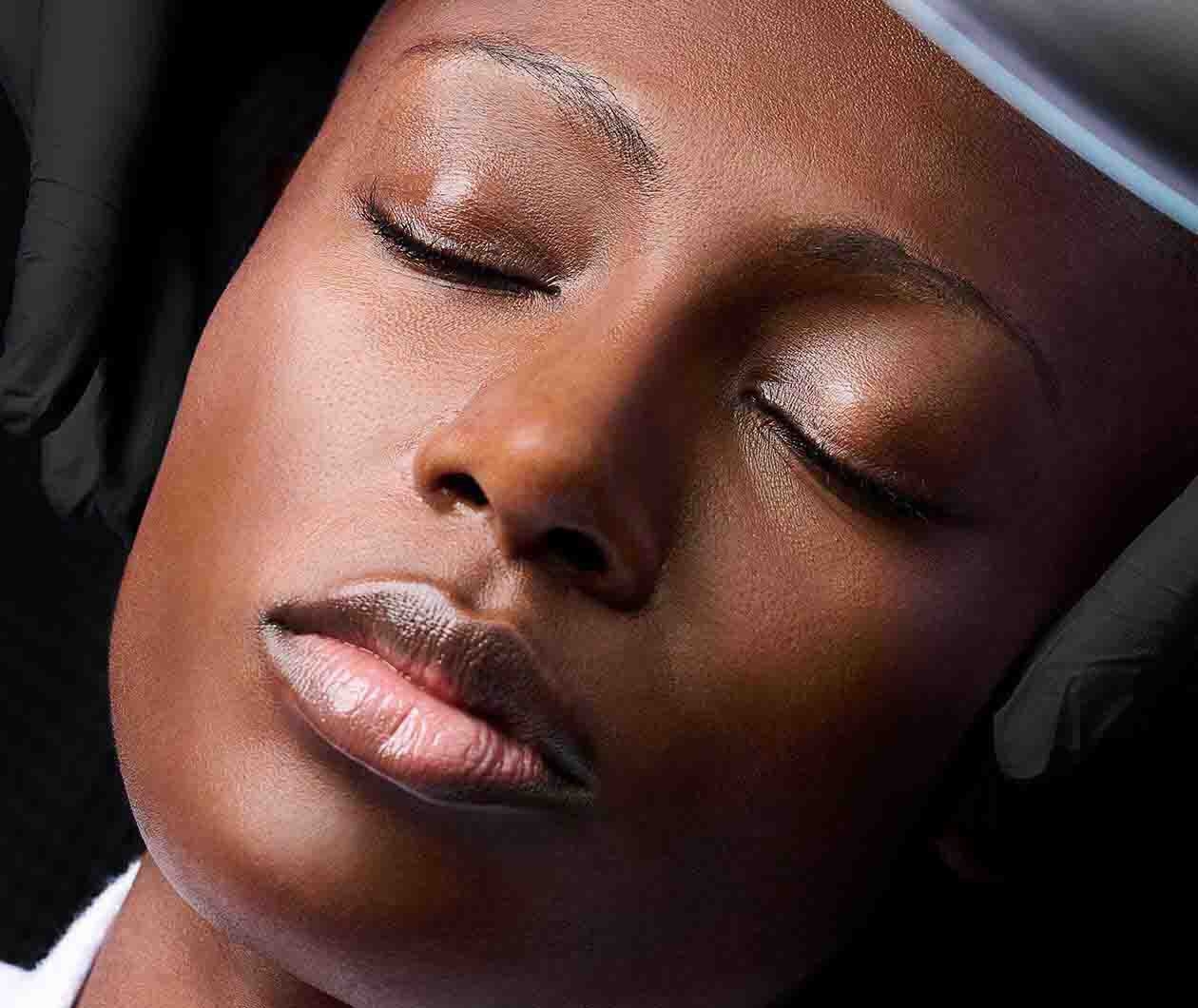 RF Microneedling  module