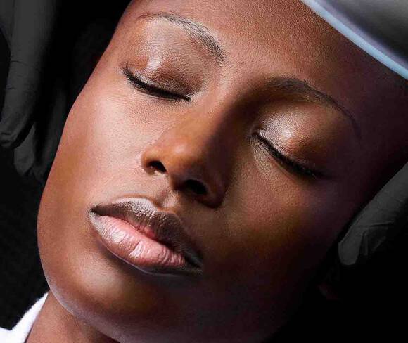 RF Microneedling module