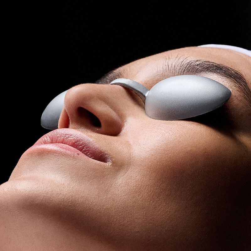 CO2 Laser Treatment
