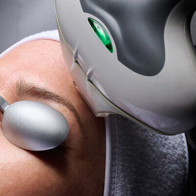 IPL Laser
