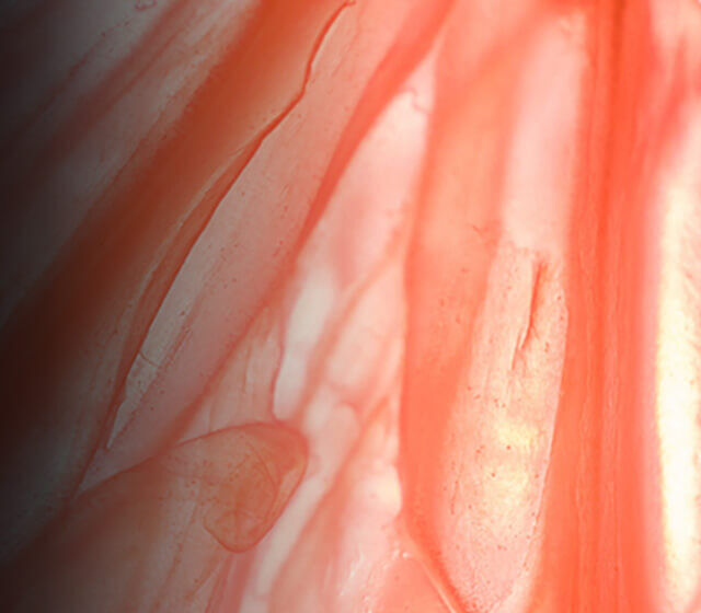 Myrixin™ Ingredient Image