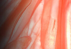 Myrixin™ Ingredient Image