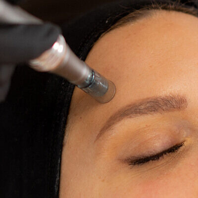 Microneedling SkinCeuticals Hero Banner