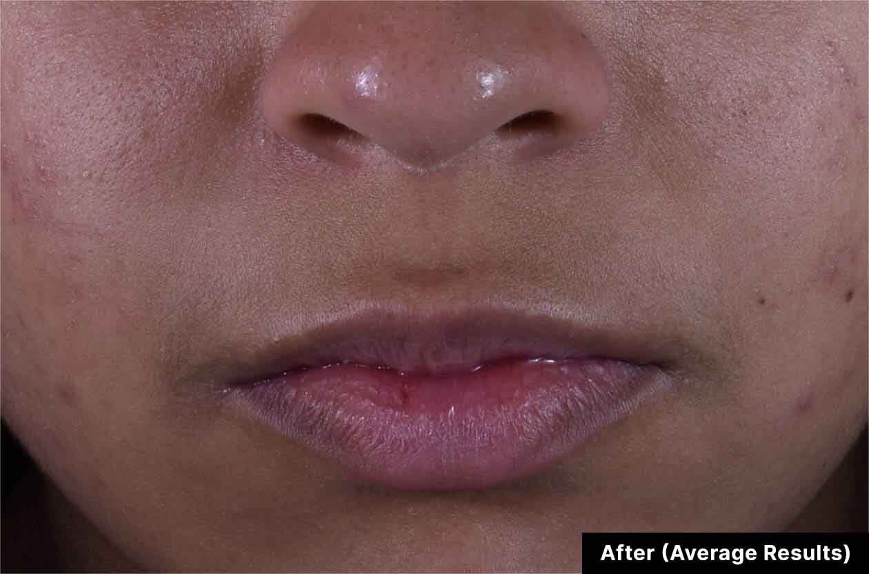 Before and After Discoloration Defense Dark Spot Corrector Serum